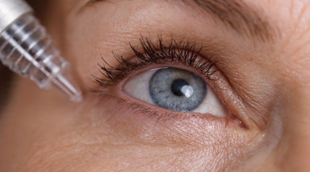 CO2 and UltraClear Laser Under Eye Recovery Time