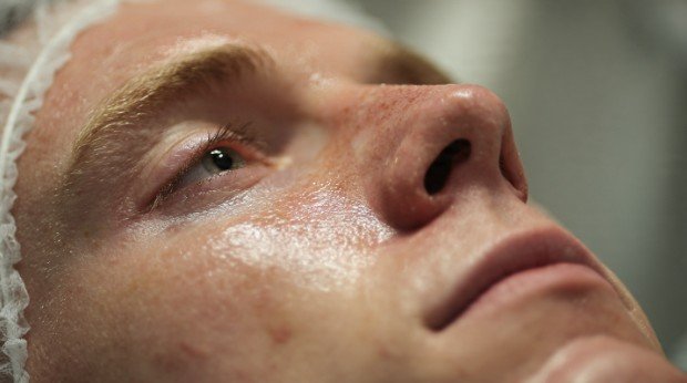 Timeline of Results What Happens After Treatment