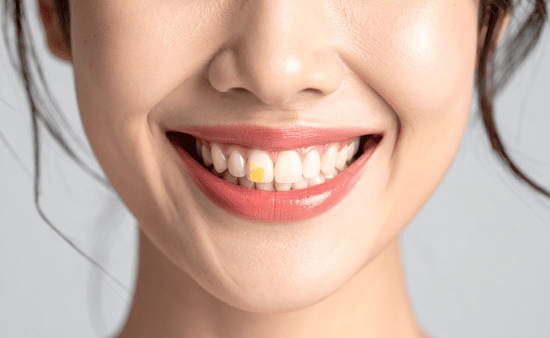 The Hidden Link Between Stress and Your Oral Health